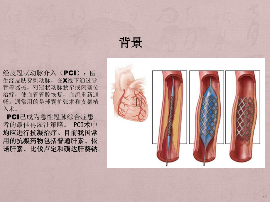 PCI围术期抗凝治疗中比伐卢定与肝素的比较ppt课件.pptx_第3页