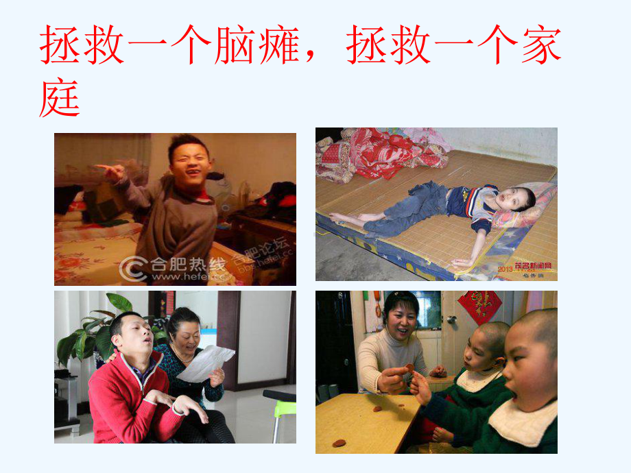 脑瘫的治疗ppt课件.ppt_第2页