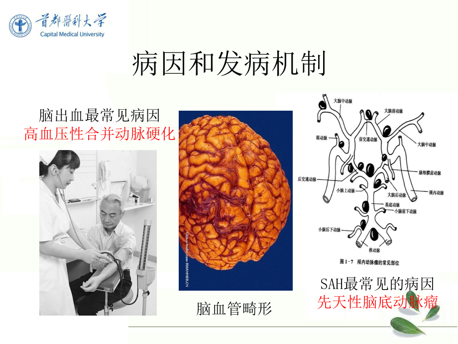 最新精品课件脑出血和蛛网膜下腔出血.ppt_第3页