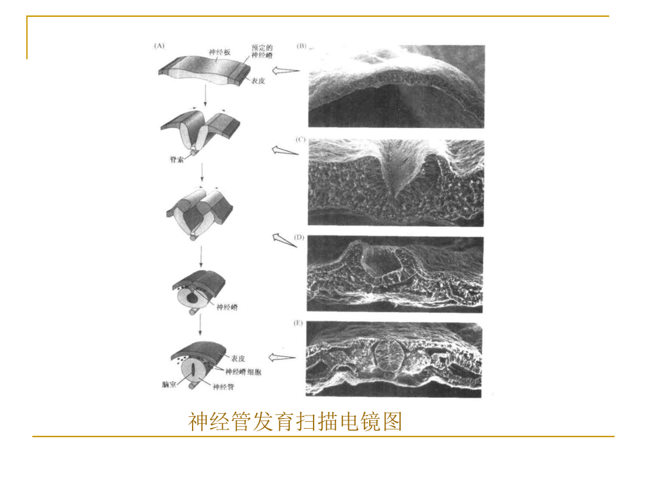 神经生物课件-神经系统发育.ppt_第3页