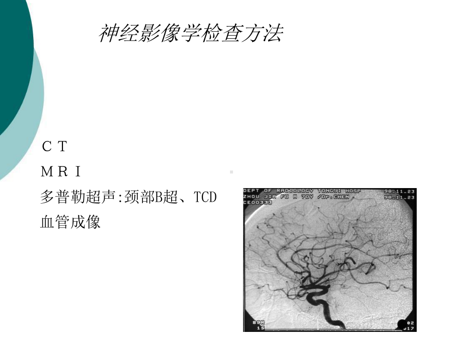 脑血管疾病的影像学诊断课件.ppt_第2页