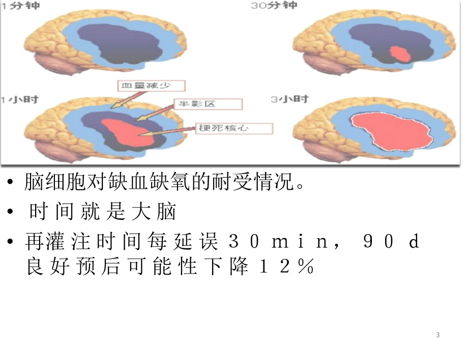 缺血性脑卒中静脉溶栓PPT课件.ppt_第3页