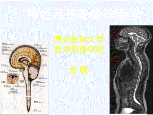 -神经系统影像检查方法及临床应用课件.ppt