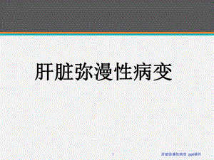 肝脏弥漫性病变-ppt课件.ppt