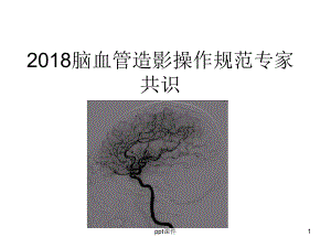 脑血管造影操作规范专家共识-ppt课件.ppt