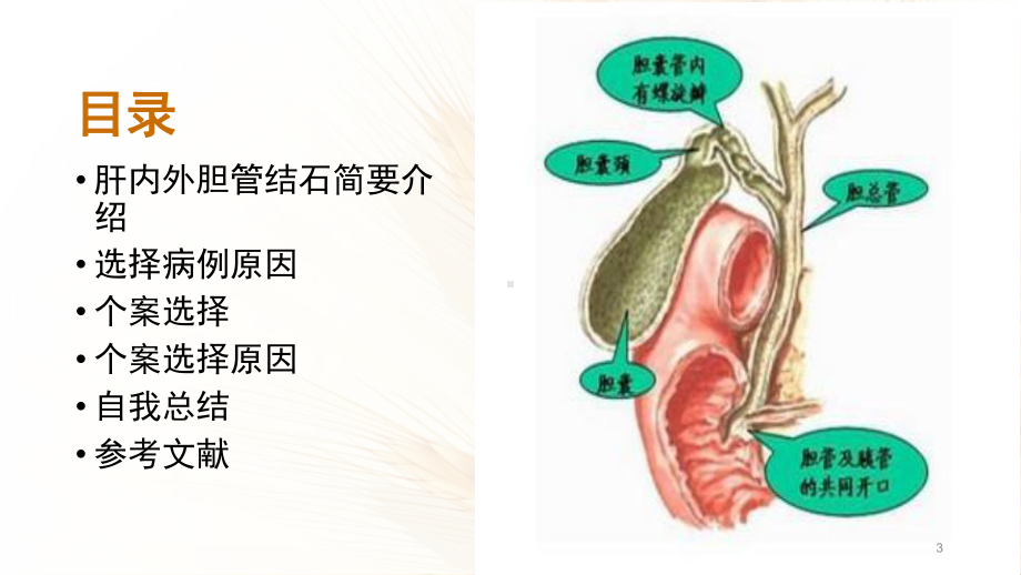 肝内外胆管结石PPT课件.ppt_第3页