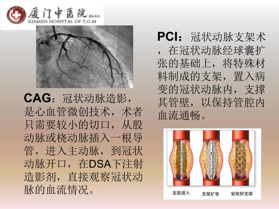 心脑病科护理品管圈课件.ppt_第2页