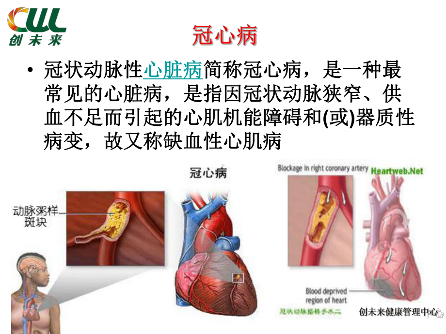 老年医学保健心脑血管疾病养护PPT课件.ppt_第3页