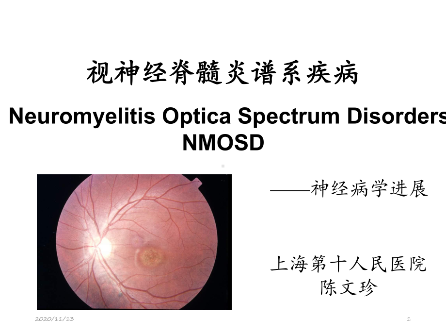 视神经脊髓炎谱系疾病陈文珍-ppt课件.ppt_第1页