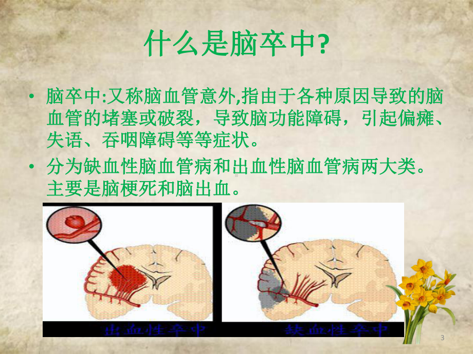 脑卒中病人的康复治疗PPT课件.ppt_第3页