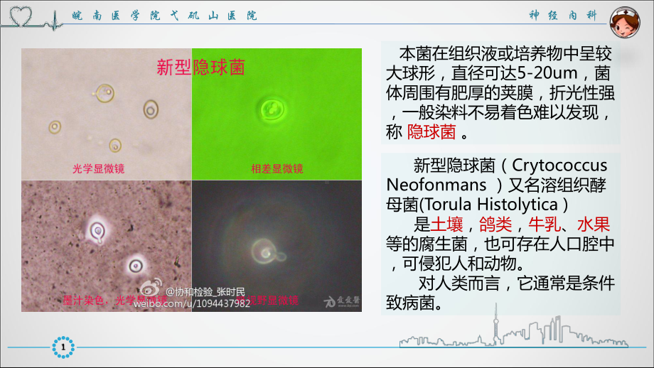 隐球菌脑膜炎PPT课件.ppt_第2页