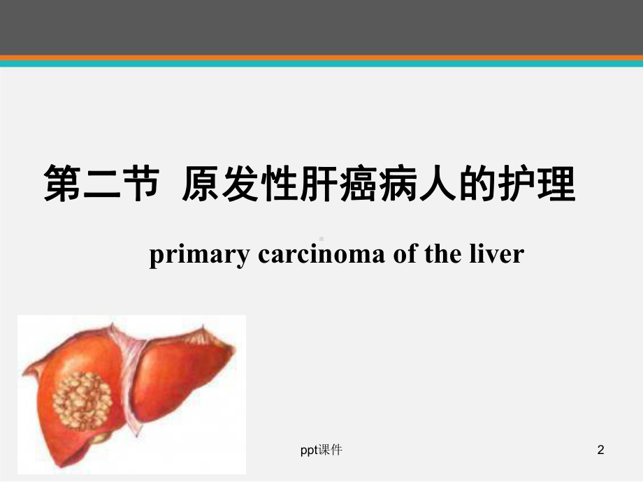 原发性肝癌的护理-ppt课件.ppt_第2页