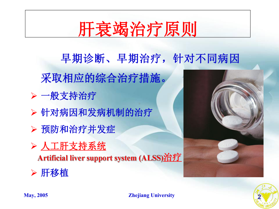 人工肝治疗指南PPT课件.ppt_第2页