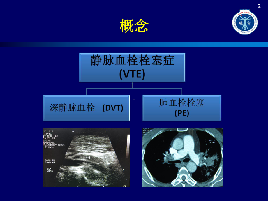 低分子肝素的分类课件.ppt_第2页