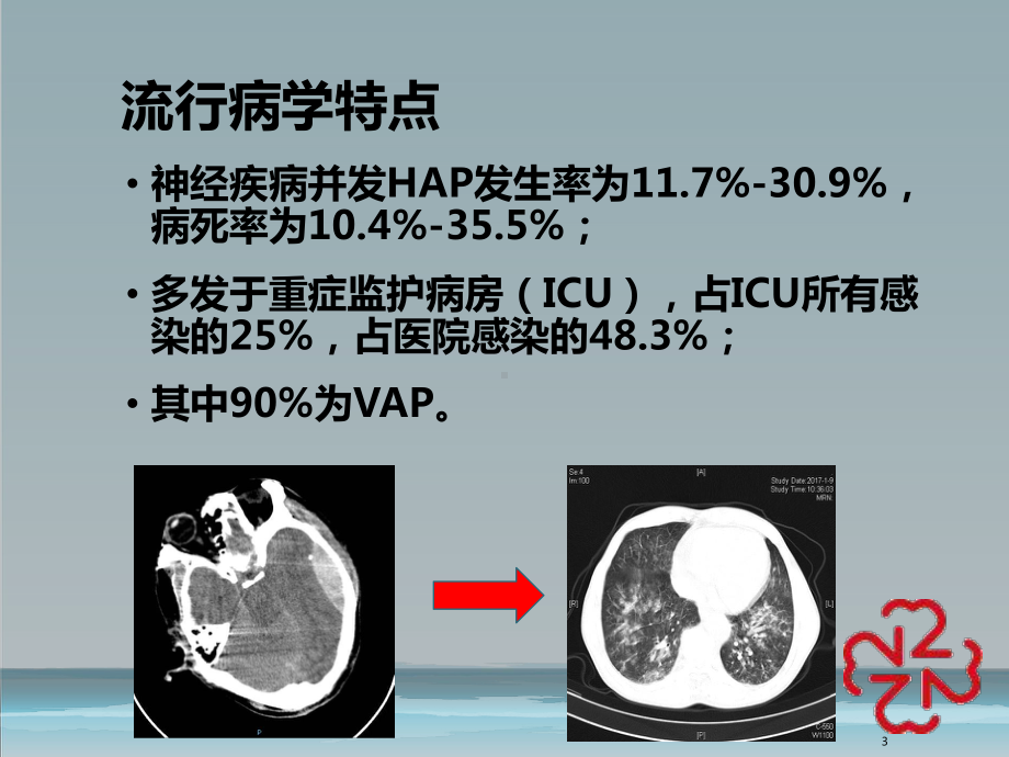 神经重症患者肺部感染的非抗生素策略PPT课件.pptx_第3页