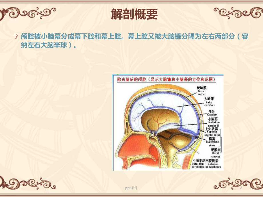 急性脑疝的护理查房-ppt课件.ppt_第3页