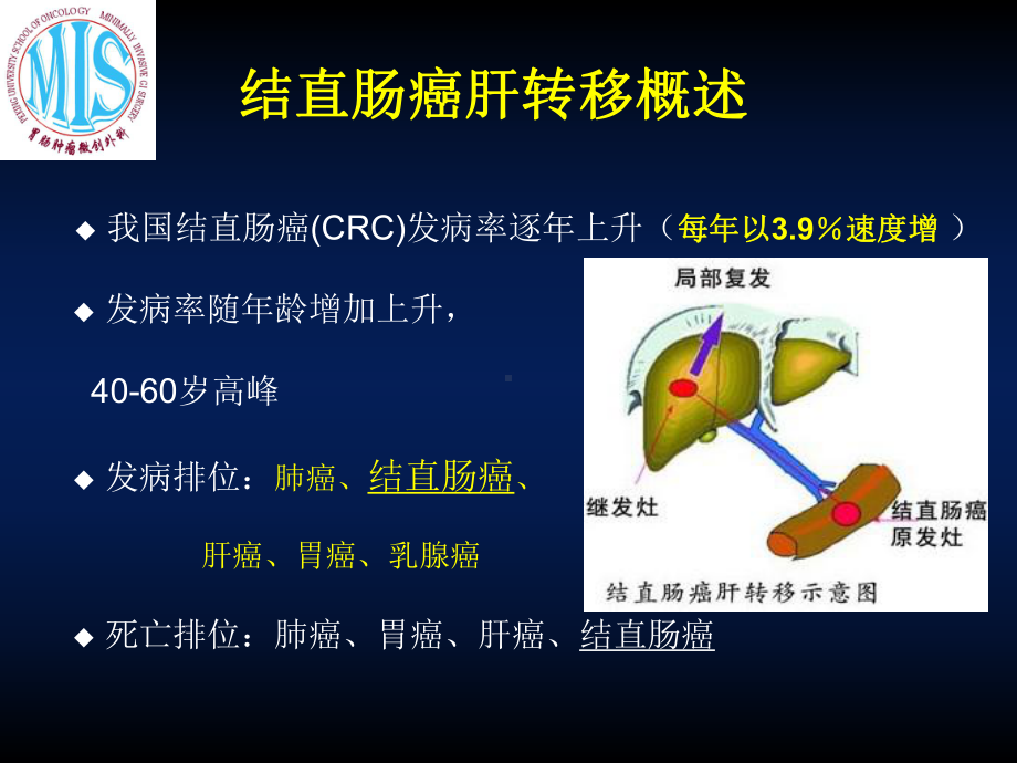 结直肠癌肝转移外科治疗PPT课件.ppt_第2页