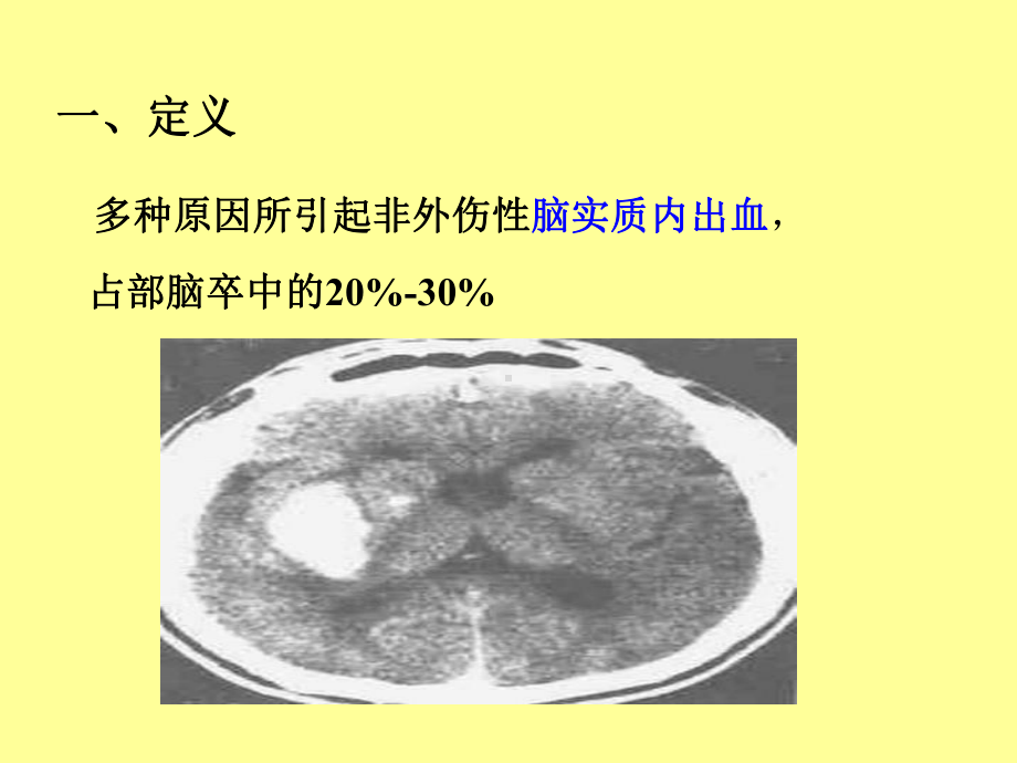 脑出血PPT精品医学课件.ppt_第2页