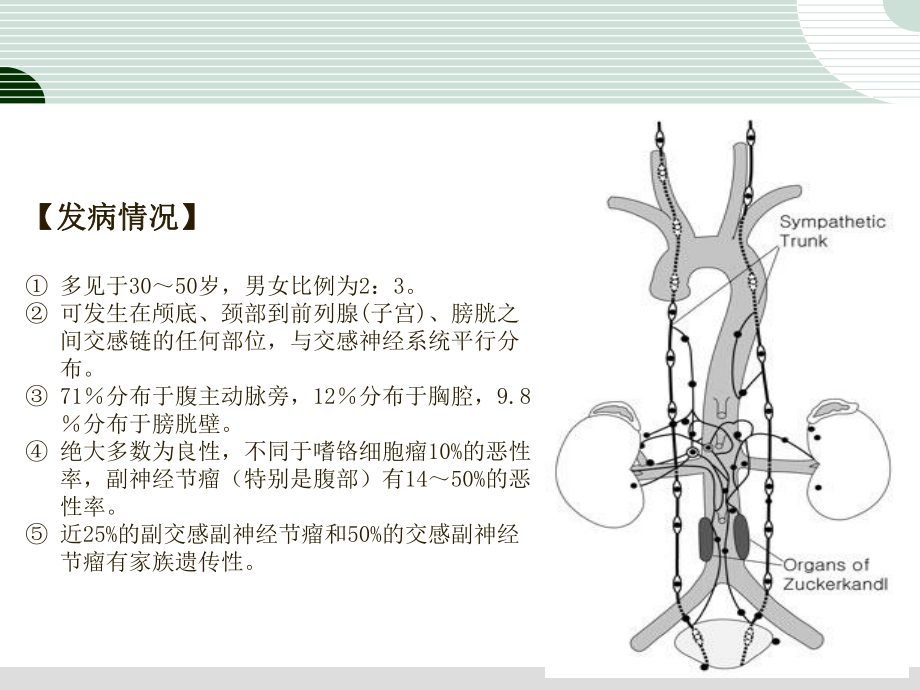 副神经节瘤PPT演示课件.ppt_第3页