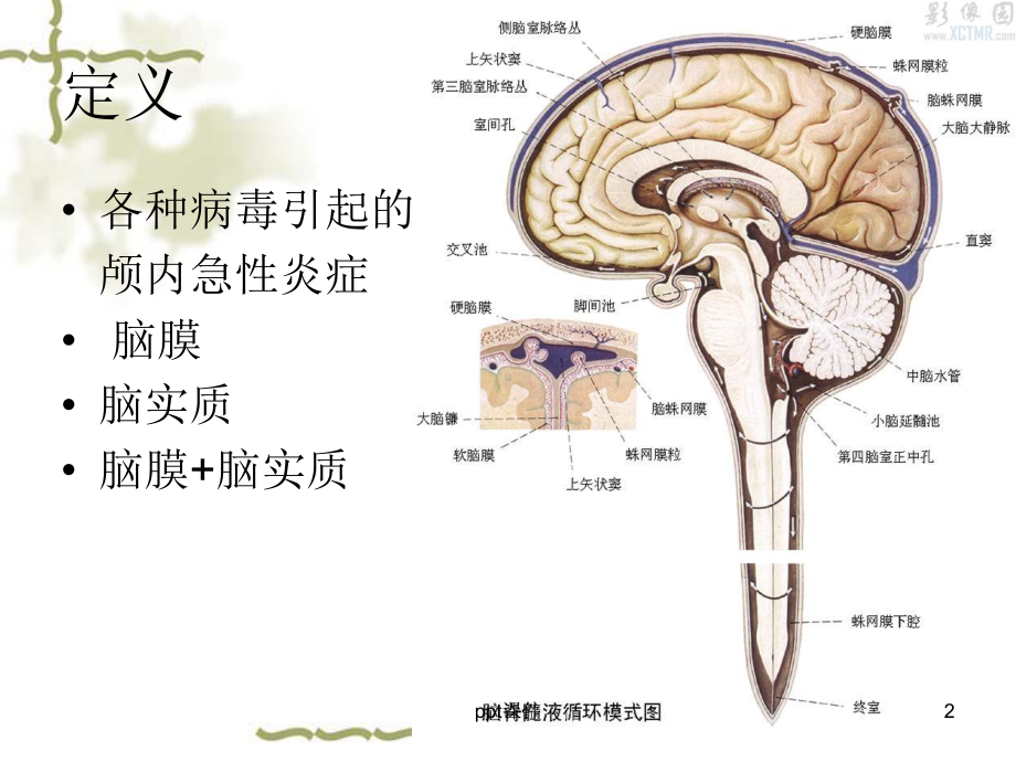 小儿病毒性脑炎（儿科）-ppt课件.ppt_第2页