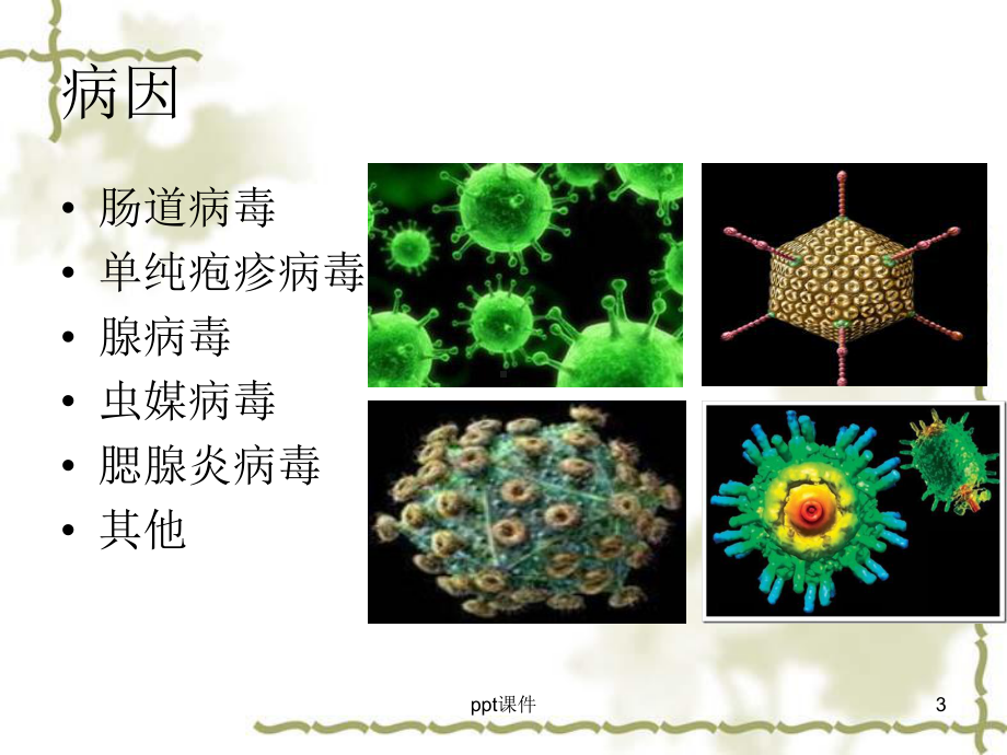 小儿病毒性脑炎（儿科）-ppt课件.ppt_第3页