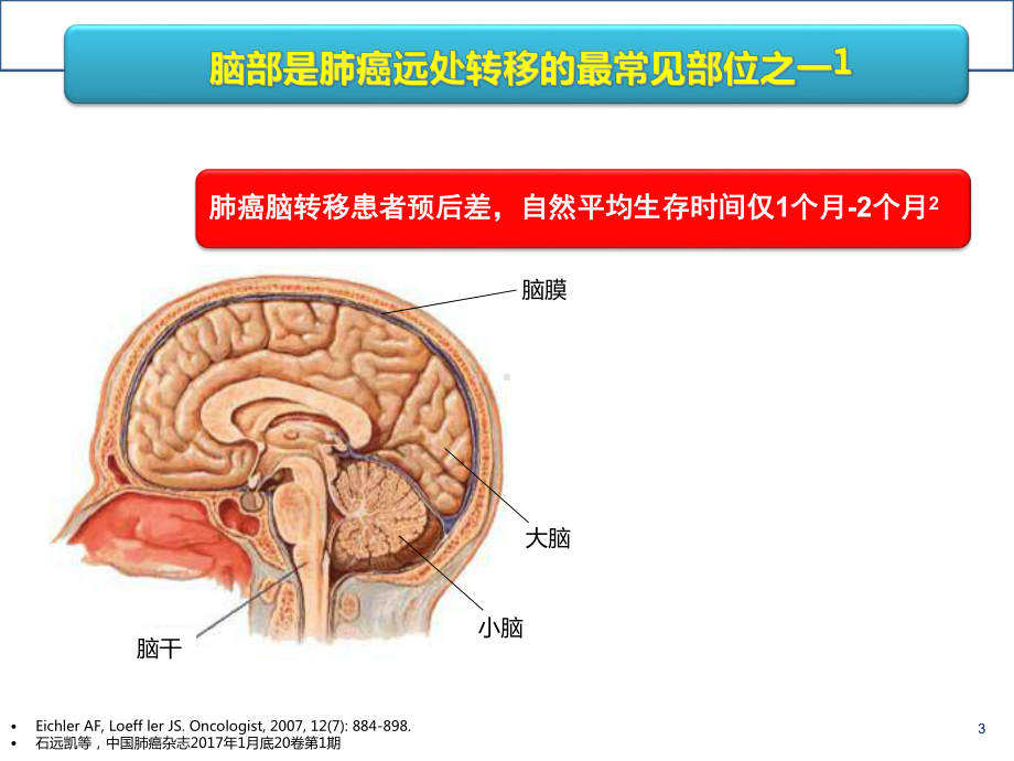 肺癌脑转移诊治课件.ppt_第3页