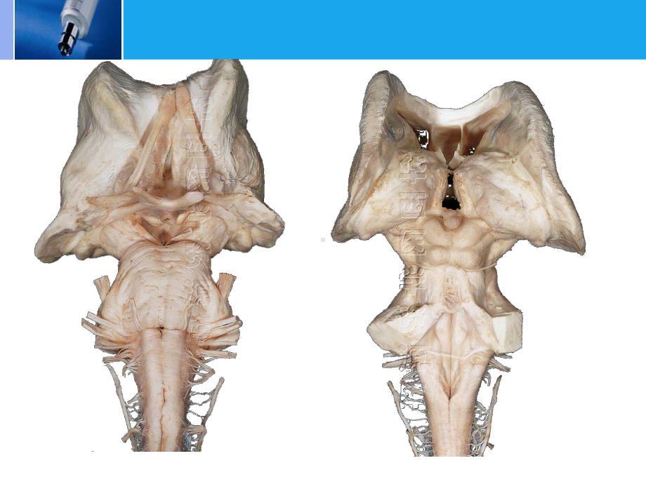 人体解剖学脑干Internalstructure课件.ppt_第3页