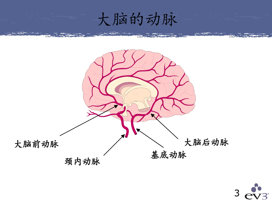 神经介入产品培训课件.ppt_第3页