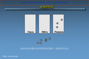 从普通肝素到磺达肝癸钠肝素类抗凝药物研发历程课件.ppt