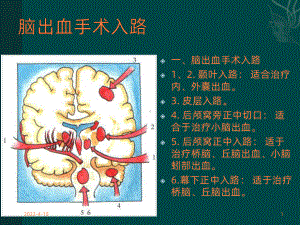 神经外科手术入路ppt课件.ppt