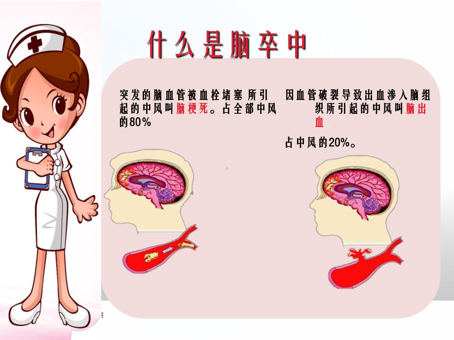 脑卒中护理查房-ppt课件.ppt_第2页