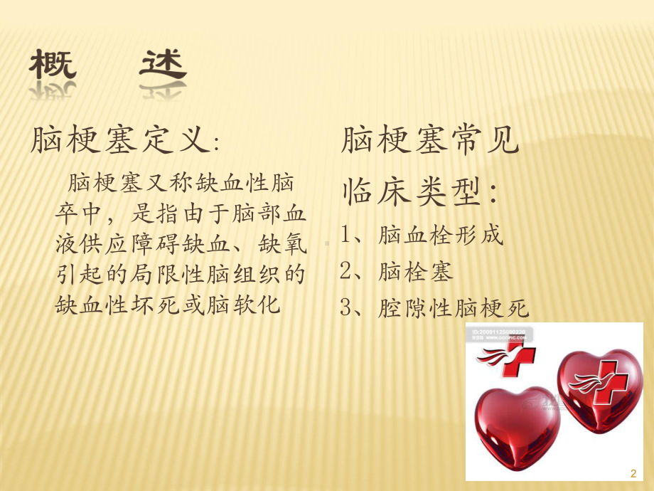 脑梗塞护理常规ppt课件.ppt_第2页