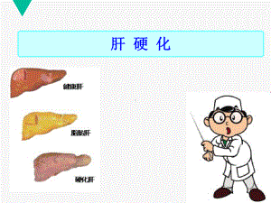 肝硬化护理查房-ppt课件.ppt