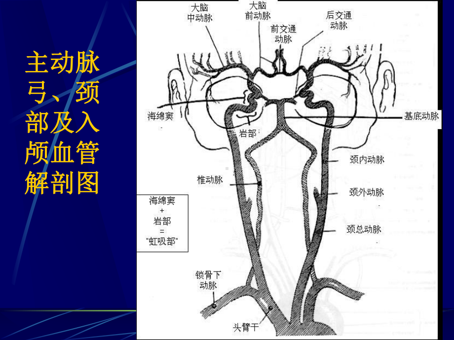 qq脑血管解剖及造影术课件.ppt_第2页