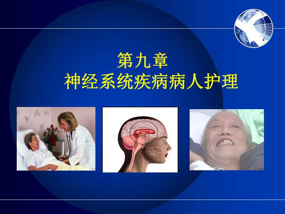 护士执业资格考试内科护理学第九章神经系统疾病病人护理 (1)课件.ppt_第1页