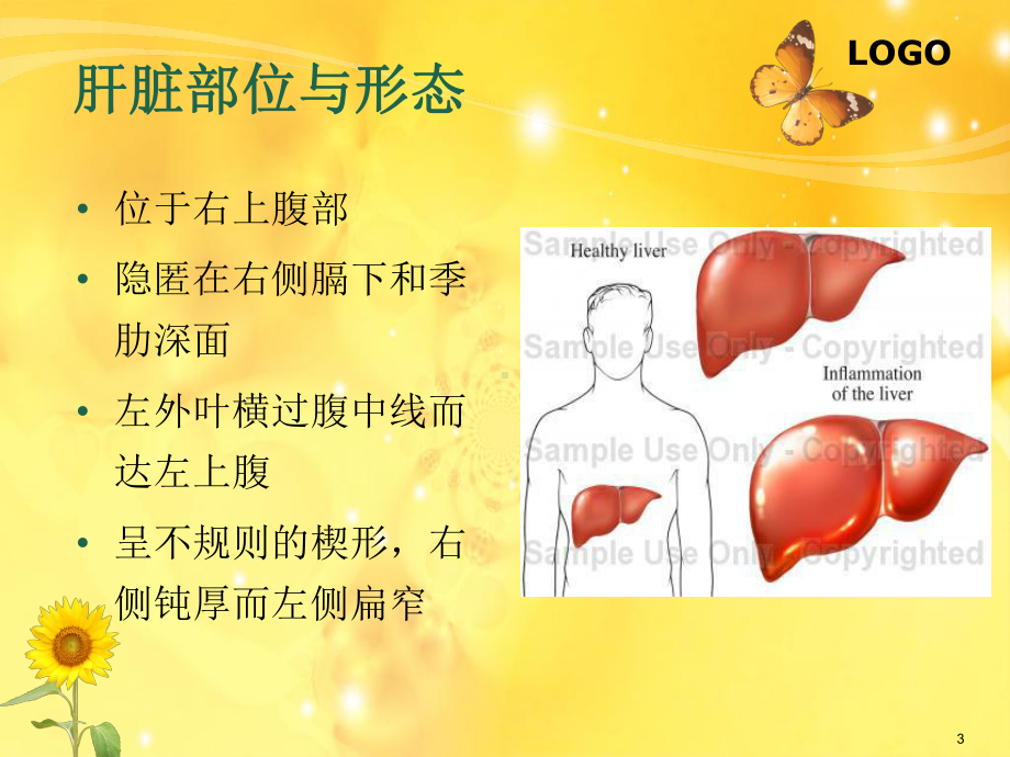 左半肝切除手术护理配合ppt课件.ppt_第3页