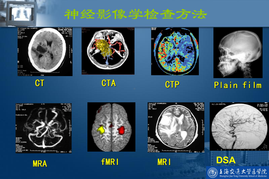 中枢神经系统影像学1课件.ppt_第2页