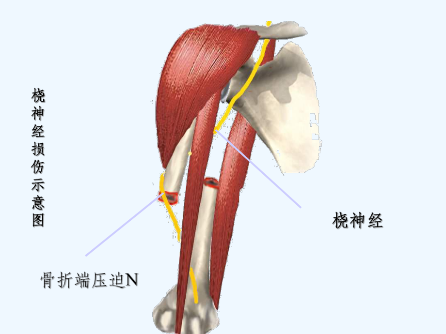 周围神经损伤(T)课件.ppt_第2页