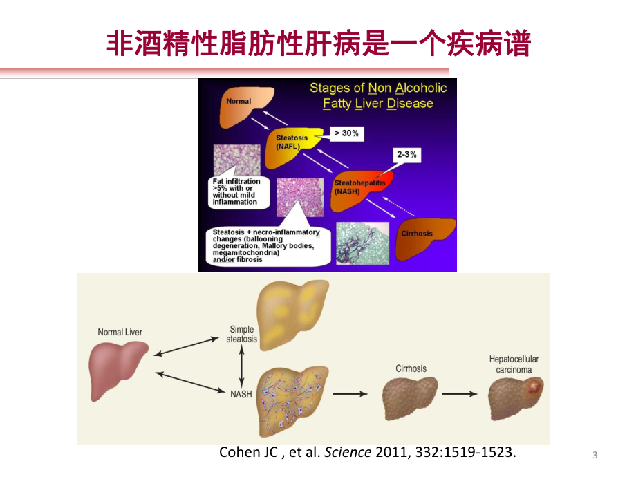 脂肪肝与糖代谢紊乱PPT课件.ppt_第3页