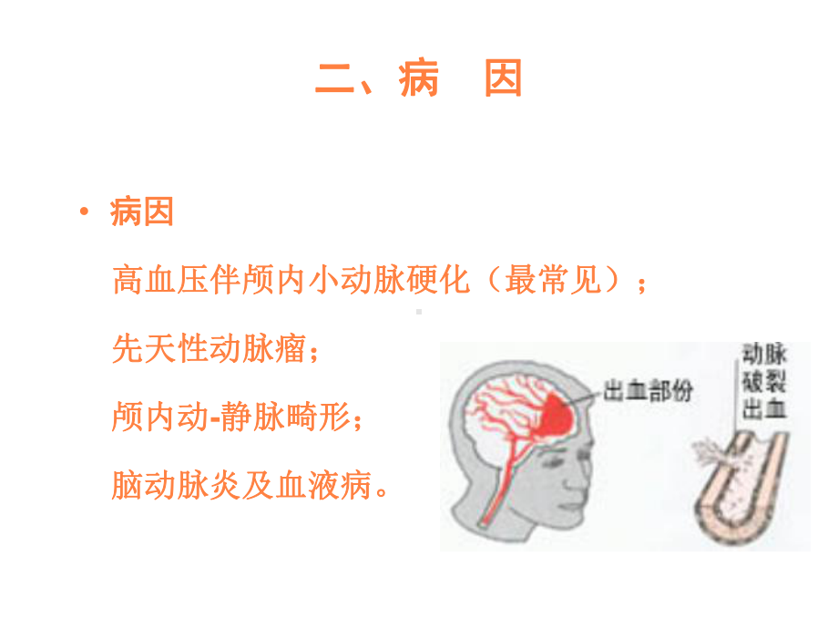 脑出血病人的护理PPT课件.ppt_第2页