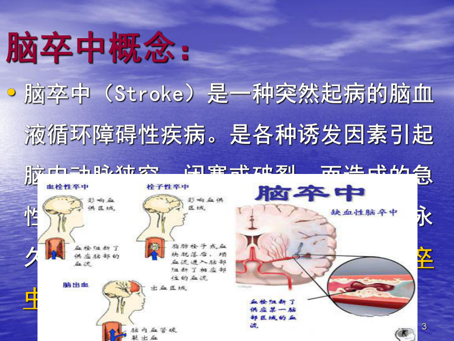 脑卒中护理新进展ppt课件.ppt_第3页