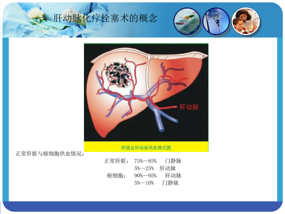 肝动脉化疗栓塞术ppt课件1.ppt_第3页