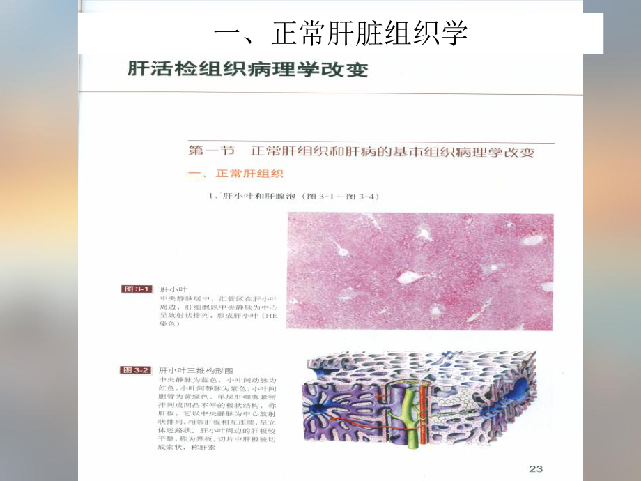 肝炎不治疗多久会演变成肝癌课件.ppt_第3页