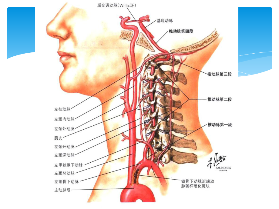 急性脑梗死的诊疗课件.pptx_第3页