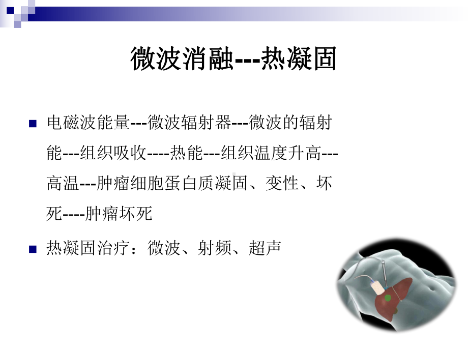 超声引导下微波消融治疗肝癌及护理课件.ppt_第2页