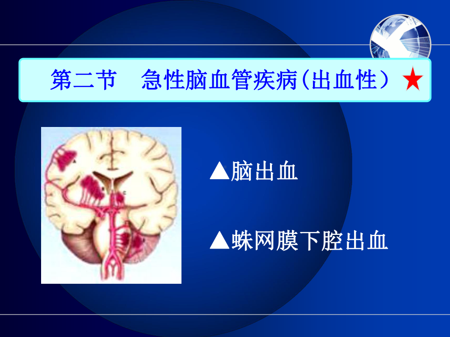 护士执业资格考试内科护理学第九章神经系统疾病病人护理 (3)课件.ppt_第2页