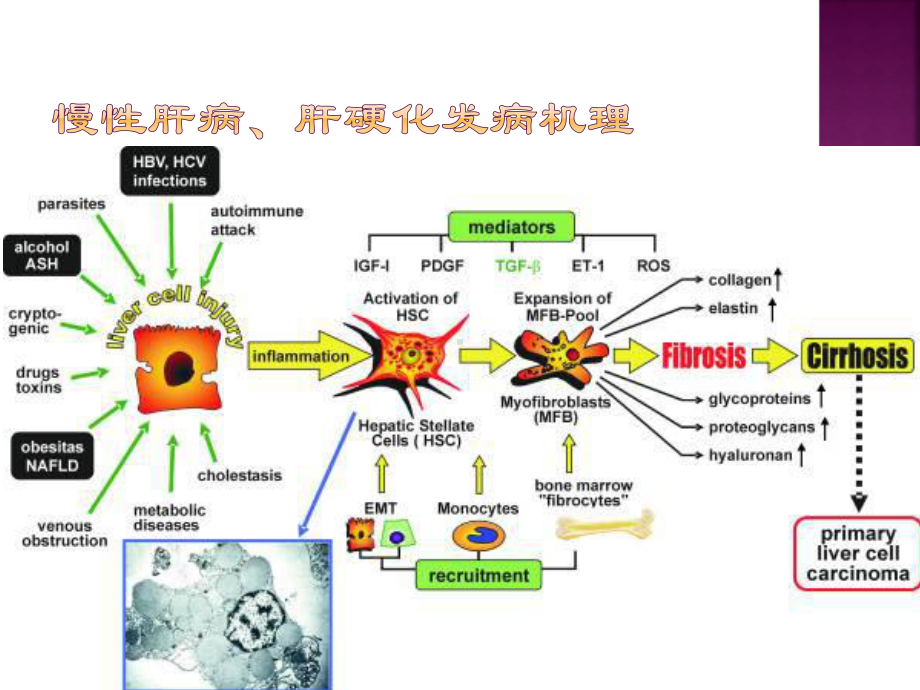 肝癌影像诊断ppt课件.ppt_第3页