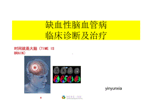 缺血性脑血管病诊断与治疗课件.ppt