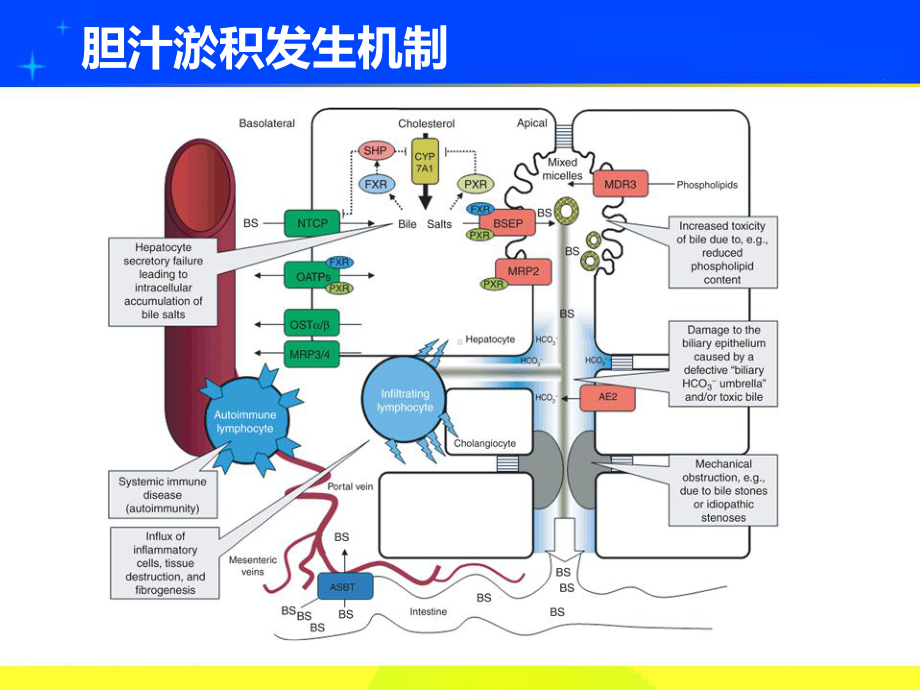 肝内胆汁淤积诊断步骤及治疗要点课件.ppt_第3页