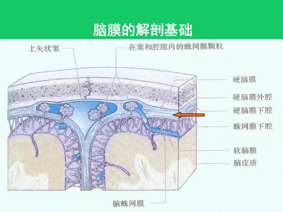 脑膜强化病变的相关临床影像学课件.ppt_第3页